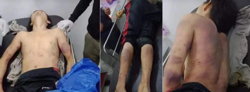 प्रहरी हिरासतमा रहस्यमय मृत्यु भएको भन्दै आफ्त आक्रोशित