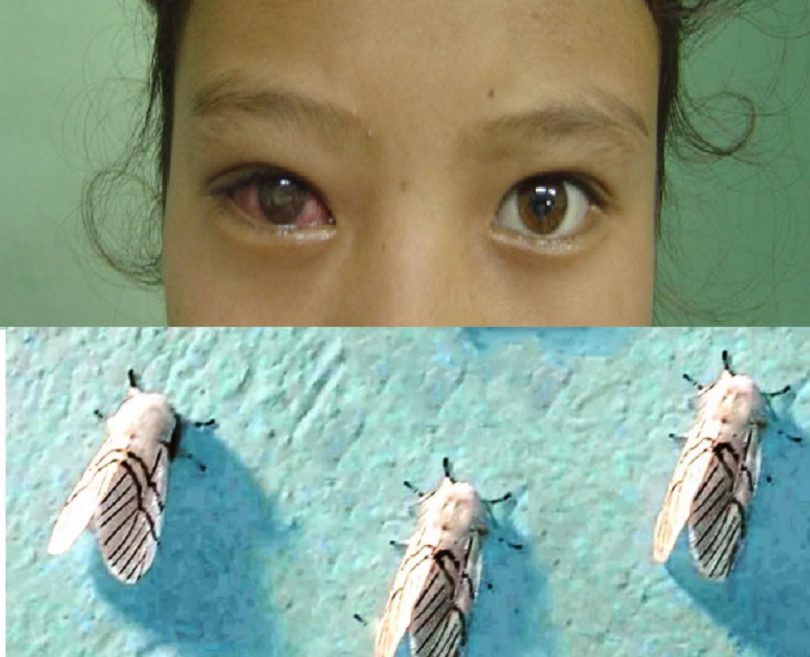 गुल्मीमा देखियो सापु रोग