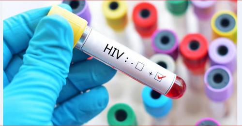 मकवानपुरमा एचआईभी सङ्क्रमित बढ्दै